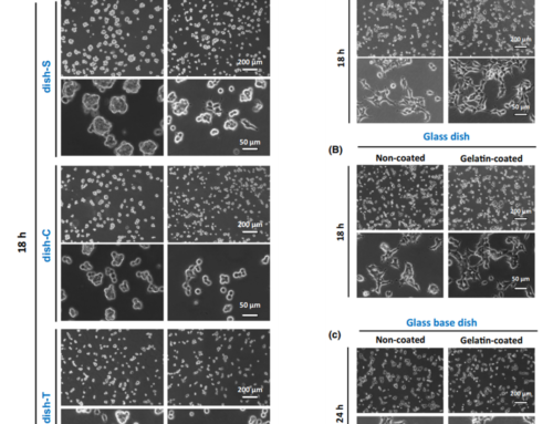 Different morphologies of HEK293T cells in various types of culture dishes