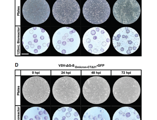 Advancements in Scalable SARS-CoV-2 Vaccine Production: The Role of Microcarrier-Based Cultures