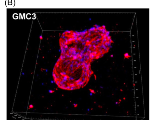 Innovative Injectable Microcarrier-Hydrogel Composite for Dental Stem Cell Delivery and Tissue Regeneration