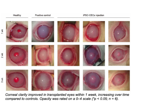 How iPSCs Are Changing the Game in Treating Corneal Endothelial Dysfunction