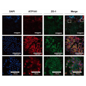 ATP1A1 and ZO-1 expression