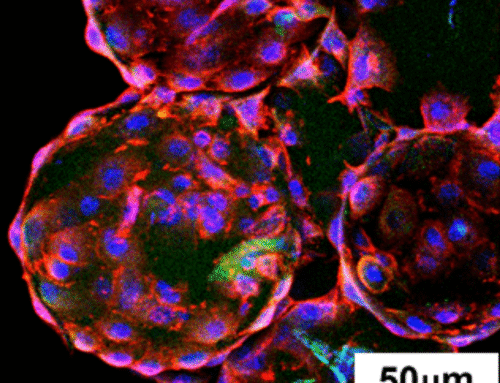 How Microcarrier Stiffness Shapes Cell Growth and Identity: New Insights for Scalable Cell Culture