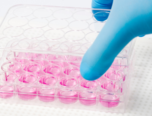 How to Minimise Unwanted Cell Attachment to Non-Microcarrier Surfaces in Microcarrier Culture