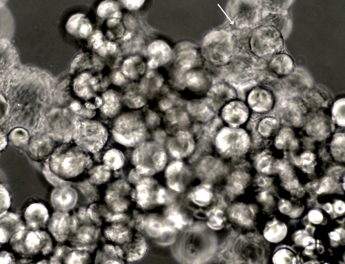 How to Minimise Cell Clumping During Microcarrier Culture