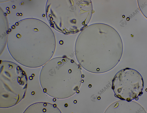 Why Are My Cells Not Attaching to the Microcarriers?